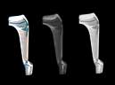 Classic Wood Stove Leg Options